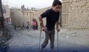 پولیو کے 2 نئے کیسز سامنے آ گئے ، رواں سال تعداد 67 ہو گئی